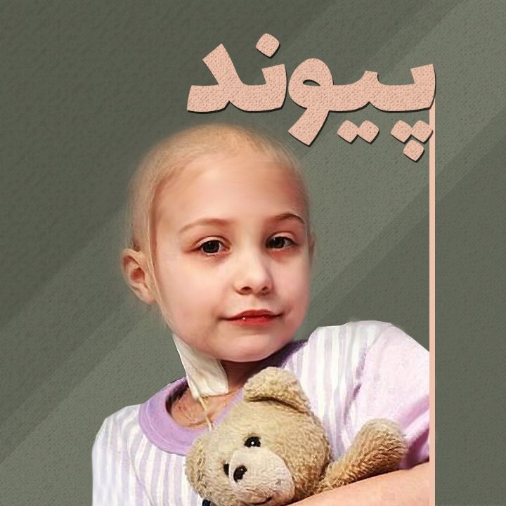 پیوند