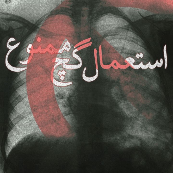 استعمال گچ ممنوع