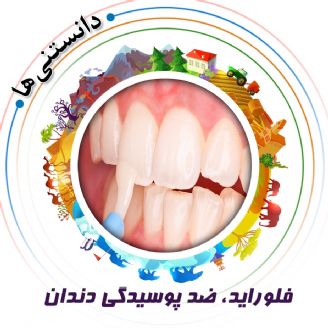 فلوراید، ضد پوسیدگی دندان